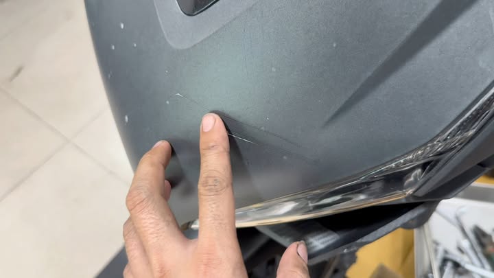 Có ai từng gặp trường hợp này chưa